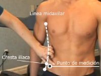 Pliegue suprailíaco